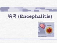 脑炎PPT课件