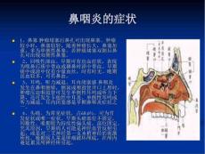 鼻咽炎的症状鼻咽炎的病因.pptx