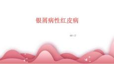 银屑病性红皮病
