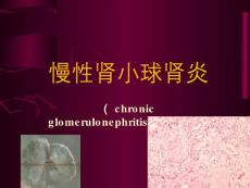 慢性肾炎、隐匿肾炎的诊断与鉴别诊断