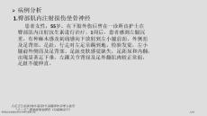 臀部肌内注射损伤坐骨神经病例分析