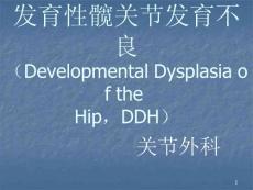 ddh髋关节发育不良