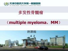 多发性骨髓瘤