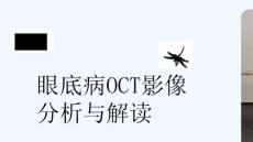 眼底病OCT解读-