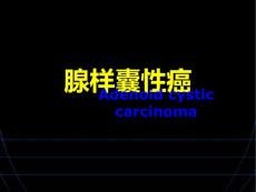 腺样囊性癌【44页】