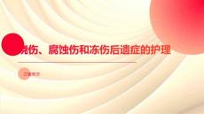 烧伤