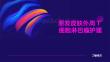 原发皮肤外周T细胞淋巴瘤护理