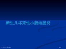 新生儿坏死性小肠结肠炎
