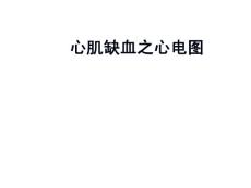 心肌缺血心电图