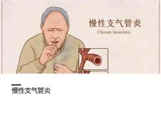 慢性支气管炎