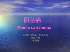 阴茎癌_精品文档