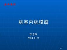脑室内脑膜瘤
