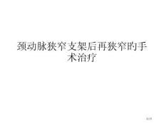 颈动脉狭窄支架后再狭窄的治疗方法
