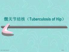 髋关节结核专题宣讲