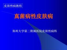 汗斑手足癣头癣培训课件