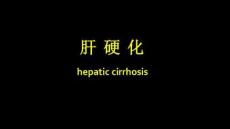 肝硬化