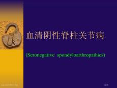AS血清阴性脊柱关节病
