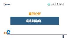 案例分析嗜铬细胞瘤