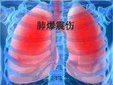 肺爆震伤PPT培训课件