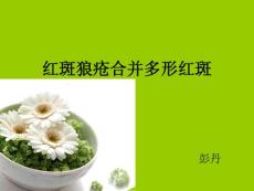 红斑狼疮和多形红斑