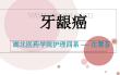 牙龈癌的护理专题宣讲PPT培训课件