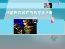 法洛氏四联症