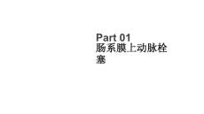 肠系膜上动脉栓塞