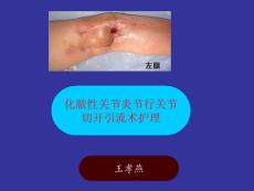 化脓性关节炎