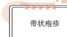 带状疱疹