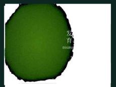 发育性髋关节发育不良课件