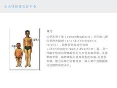 先天性软骨发育不良