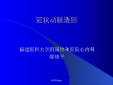 冠状动脉造影
