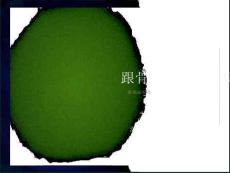 跟骨骨折诊治