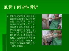 第七節 骨折固定術