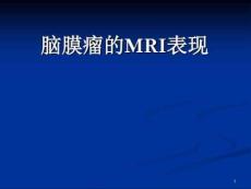 脑膜瘤MRI诊断