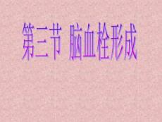 脑血栓 ct检查