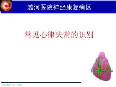 常見心律失常的識別課件