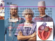 心脏粘液瘤护理查