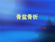 骨盆骨折【33页】