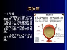 膀胱癌【52页】