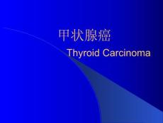 【大学课件】甲状腺癌