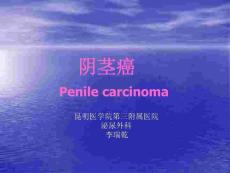 阴茎癌专题知识宣讲