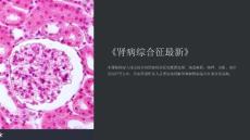 《肾病综合征》课件