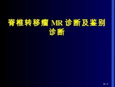 脊柱转移瘤的诊疗和鉴别诊疗