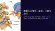 《腰椎间盘突出》课件