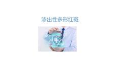 渗出性多形红斑2025