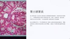 《肾小球肾炎》课件
