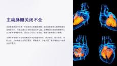 《主动脉瓣关闭不全》课件