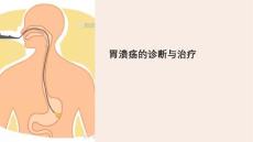 《胃溃疡》课件