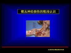 臂丛神经损伤的粗浅认识